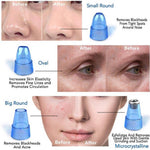 Blackhead Remover Pore Vacuum And Facial Cleanser Device for Pores Acne Nose Skin